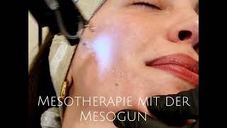 Mesotherapie mit der Mesogun im Urban Spa Hamburg [upl. by Claudian]