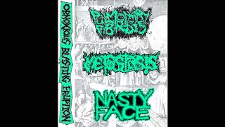 Pulmonary Fibrosis  Metastasis  Nasty Face  Obnoxious Blasting Eruption 3 way split [upl. by Annayhs]