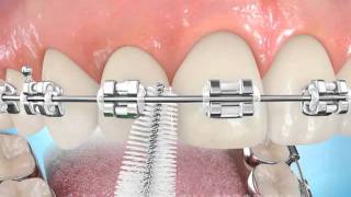 Uso de cepillo interdental [upl. by Ileak]