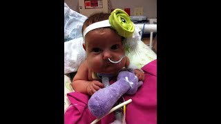 Feighlyns Story  2019 Omphalocele Awareness [upl. by Nannie]