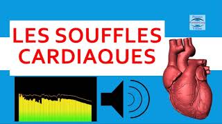 ❤ Souffle au coeur écoutez les bruits cardiaques anormaux auscultation audio cours cardiologie [upl. by Candra]