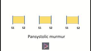 Pansystolic murmur [upl. by Enahsed753]