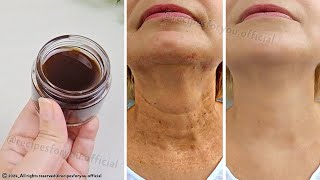 Anti aging magic oil ☘️ This oil will erase all the wrinkles on your face stronger than Botox [upl. by Bullion]