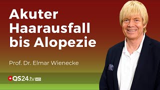 Haarausfall  Alopezie Studie zeigt die Ursache ist leicht behandelbar  QS24 [upl. by Delmore]