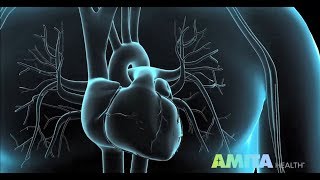 Coronary Angiography amp Cardiac Catheterization — AMITA Health [upl. by Lledo]