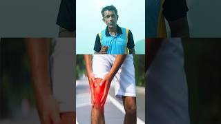 হাঁটুর ক্ষয় হয়েছে বুঝবেন কি করে  How to know about knee Osteoarthritis shorts ytshorts kneeoa [upl. by Berck295]