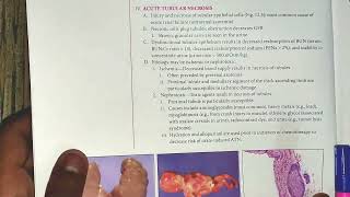 Renal pathology from pathoma part1 [upl. by Katti443]