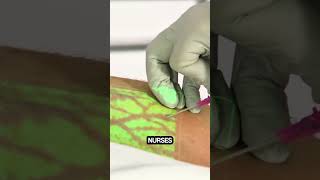 Vein finder facts knowledge didyouknow veinfinder medicaldevice science healthcare [upl. by Ydnolem88]