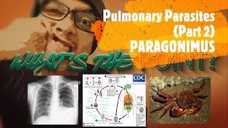 PULMONARY PARASITES Part 2 of 3  PARAGONIMUS [upl. by Cusick]