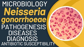 Neisseria gonorrhoeae pathogenesis  Gonorrhoea pathogenesis and microbiology [upl. by Franz]