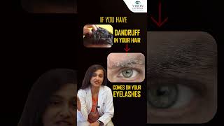 5 Causes Stye on Your Eyelid   How To Get Rid Of Stye From Eye  Vision Eye Centre [upl. by Hansel]