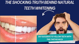 Say Goodbye to Yellow Teeth with This Tartar Hack [upl. by Ihana610]