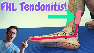 Flexor Hallucis Longus PAIN FHL Tendonitis BEST Treatment [upl. by Ahsoem]