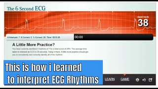 Learn to interpret ECG rhythm with the game [upl. by Suhpoelc]