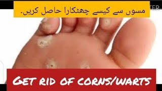 Getrid of CornWarts on foot by Dr Amara 2024Duofilm Lotion Uses in Urdu HindiDr Health [upl. by Neltiac893]