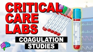 Coags  Coagulation Studies  Critical Care Labs [upl. by Esilrac]