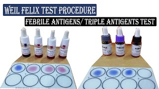 Weil Felix Test ।। Febrile Antigens Triple Antigens Test Procedure Full Details [upl. by Elleinet795]