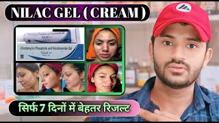 Nilac gel uses in hindi how to use nilac gel [upl. by Susanne]