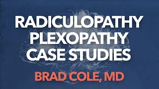 Radiculopathy Plexopathy case studies 1 [upl. by Canty]