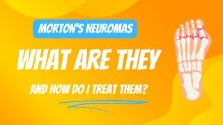 Mortons Neuroma Natural Treatment  Chiropractor  Kennewick WA [upl. by Pilihp]