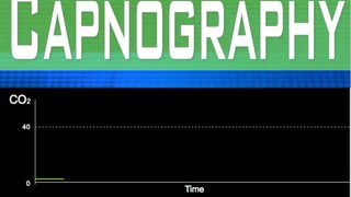 EtCO2 Capnography Part 2 [upl. by Jaunita]