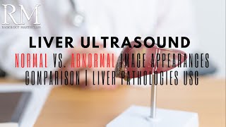 Liver Ultrasound Normal vs Abnormal Image Appearances Comparison  Liver Pathologies USG [upl. by Rosemare]