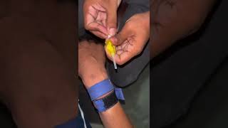 How to insert iv cannula iv cannula kaise lagate hain iv cannula insertion iv Cannulation shorts [upl. by Acirrehs]