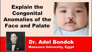 Explain the Congenital Anomalies of the Face and Palate Dr Adel Bondok [upl. by Uamak]