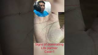 Signs of Dominating LifePartner in Palmistry marriageline [upl. by Mowbray390]