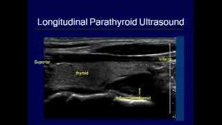 ATA Fellows Track 2012 Thyroid Ultrasound Course [upl. by Lilli]