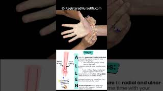 Modified Allen Test Demonstration amp Nursing Mnemonic nursing nurse rn nursingschool [upl. by Hsihsa]