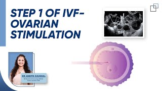 Ovarian stimulation  Step 1 [upl. by Ettolrahc]