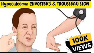 Hypocalcemia Signs and Symptoms  CHVOSTEKS amp TROUSSEAU SIGN [upl. by Aehcim]