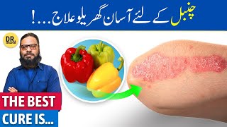 ChambalPsoriasis Ka Gharelu Ilaj  Treatment for Psoriasis  Dr Ibrahim [upl. by Trstram]