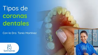 Tipos de coronas dentales [upl. by Ennaoj]