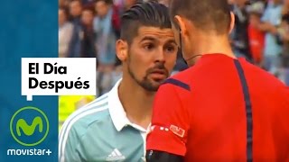 El Día Después 26102015 Nolito se Topa con Keylor [upl. by Ainitsirc341]