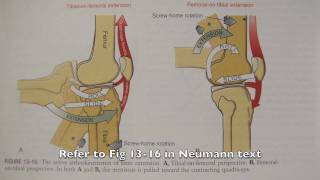 OT 440 Kinesiology Lower extremity knee locking mechanism [upl. by Aydni344]