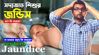 নবজাত শিশুর জন্ডিস  Newborn Jaundice  গুরুত্বপূর্ণ টিপস  Neonatal Jaundice  How to stop [upl. by Attenehs]