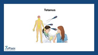 Tetanus [upl. by Moffitt]