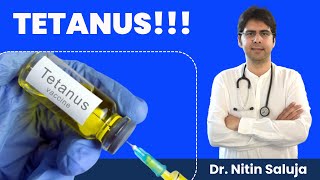 💉 Tetanus Injection time limit after injury I 💉 Tetanus  Symptoms amp Treatment [upl. by Soane]