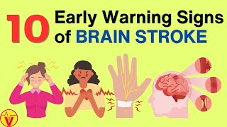 10 Warning Signs of Stroke One Month Before It Happens  VisitJoy [upl. by Aihsekin228]