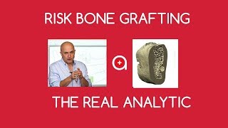 FAQ N°1 Risk of bone grafting by Prof Ihde [upl. by Aceber581]