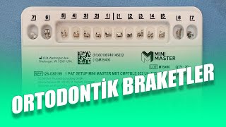 Ortodontik Braket Nedir Braket Çeşitleri Nelerdir Ortodonti Braketlerinin Özellikleri Nelerdir [upl. by Nalloh]