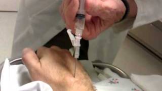 Ganglion Cyst aspiration  removal D [upl. by Nahsin731]