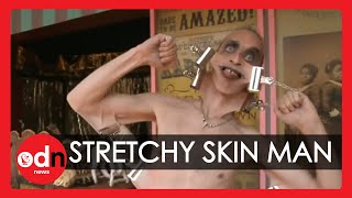 Meet the man with the worlds stretchiest skin  WEIRD [upl. by Aural]