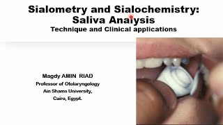 Sialometry and Sialochemistry Saliva analysis [upl. by Ahseihs]