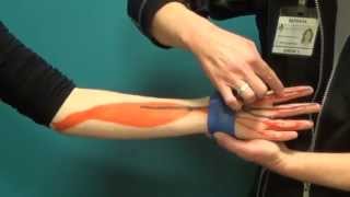 Managing Carpal Tunnel Syndrome  Rehabilitation Institute of Chicago at Silver Cross Hospital [upl. by Myer]