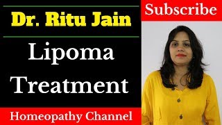 Homeopathic Medicine For Lipoma  Homeopathic Treatment [upl. by Nattie]