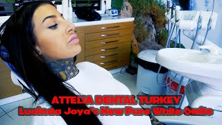 Lucinda Joya‘s New Pure White Smile  Attelia Dental Clinic Turkey [upl. by Yolane277]