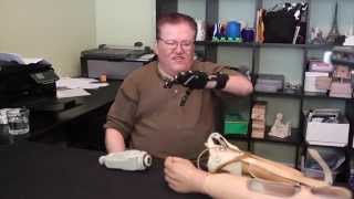 A 50 3DPrinted Prosthesis Compared to a 42000 Myoelectric Prosthesis 3D Universe [upl. by Spada]